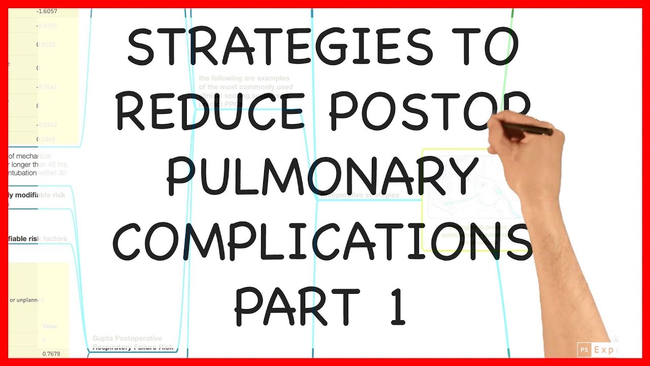 STRATEGIES TO REDUCE POSTOPERATIVE PULMONARY COMPLICATIONS PART 1 -PRACTICAL CONDUCT SERIES