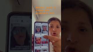 #tiranaalbania #tirana #tiranalive #tironalili #tiron #shqipria #kosovatoday