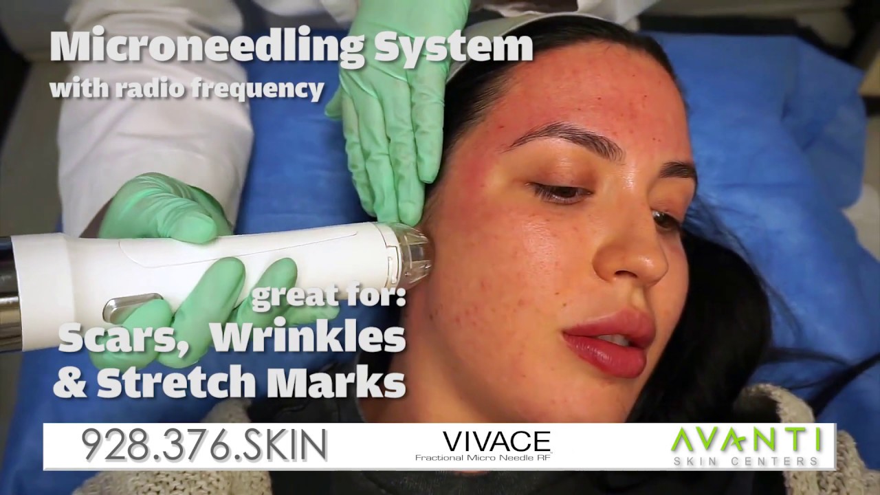 AVANTI - VIVANCE YCM 7868 Avanti Vivace 1x15 ENG 06-05-2019