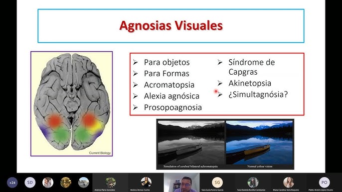 Agnosias Visuales: ¿Qué le pasaba al hombre que confundió a su mujer con un  sombrero? 