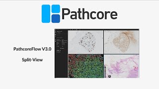 PathcoreFlow V3.0 - Split-View screenshot 1