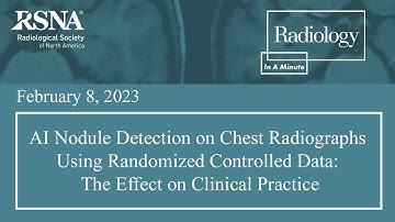 AI Nodule Detection at Chest Radiography