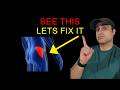 If This Muscle Is Weak, Sciatica Won’t Go Away