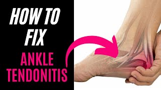 How To Treat Ankle Tendonitis
