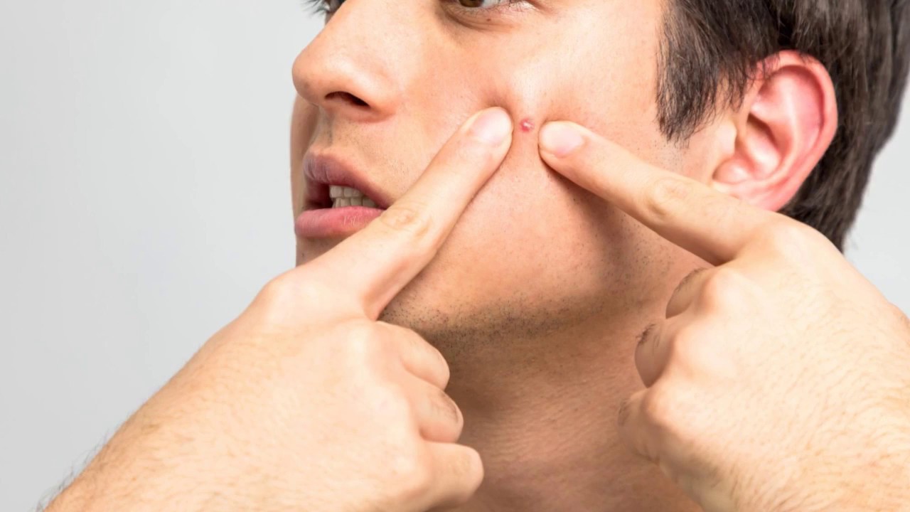 skin care tips for teenage guys