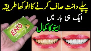 The secret that dentists don't wantyou to know: Removes tartar andwhitens teeth in 2 minutes Resimi