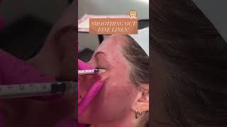 Smoothing Out Fine Lines