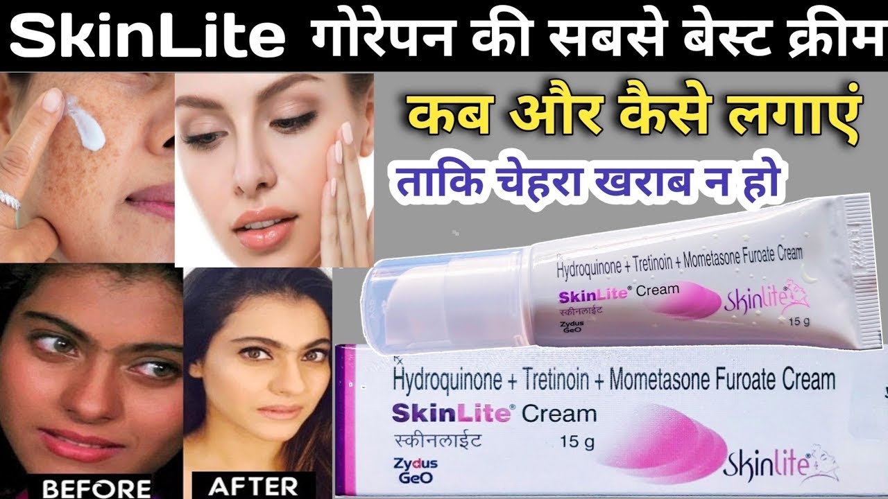 Skin Lite Cream Use Kaise Karen SkinLite Cream Review In Hindi YouTube Skin Lite Cream Use Kaise Karen SkinLite Cream Review In Hindi YouTube