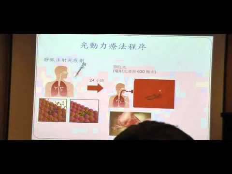肺癌的治療與照護 李章銘醫師 Youtube 肺癌的治療與照護 李章銘醫師 Youtube