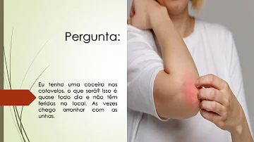 O que quer dizer coceira no cotovelo?