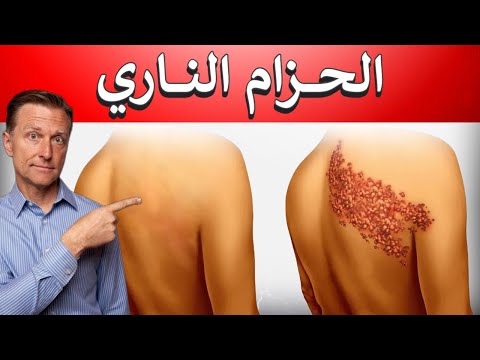 فيديو: هل يعزز تعدد الأشكال القابلية للتمدد؟