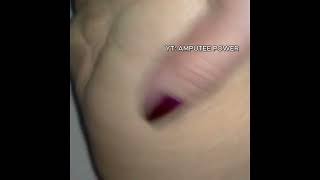 Massaging A Beautiful Stump Of A Beautiful Woman