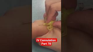 Baby IV Line 💉 | Yellow Cannula Technique | Nurse Training 👶💛 #shorts #viral #baby #ivcannulation