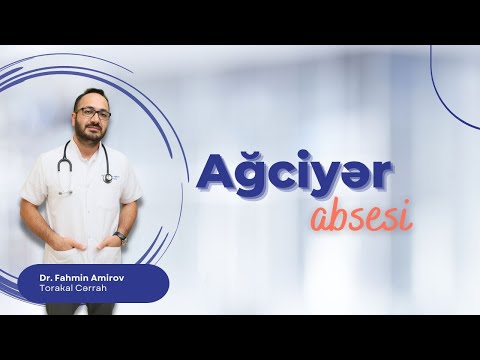 Video: Hansı ağciyərləri etməliyəm?