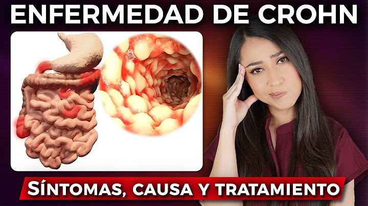 What is CROHN'S DISEASE?👩🏻‍⚕️ l Cause, SYMPTOMS and treatment