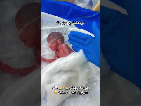 طفل مولود بالشهر الخامس تمريض حضانه متابعة