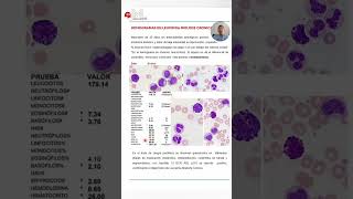 #1- HEMOGRAMA Y FSP EN  LMC. #hematologia #medicina
