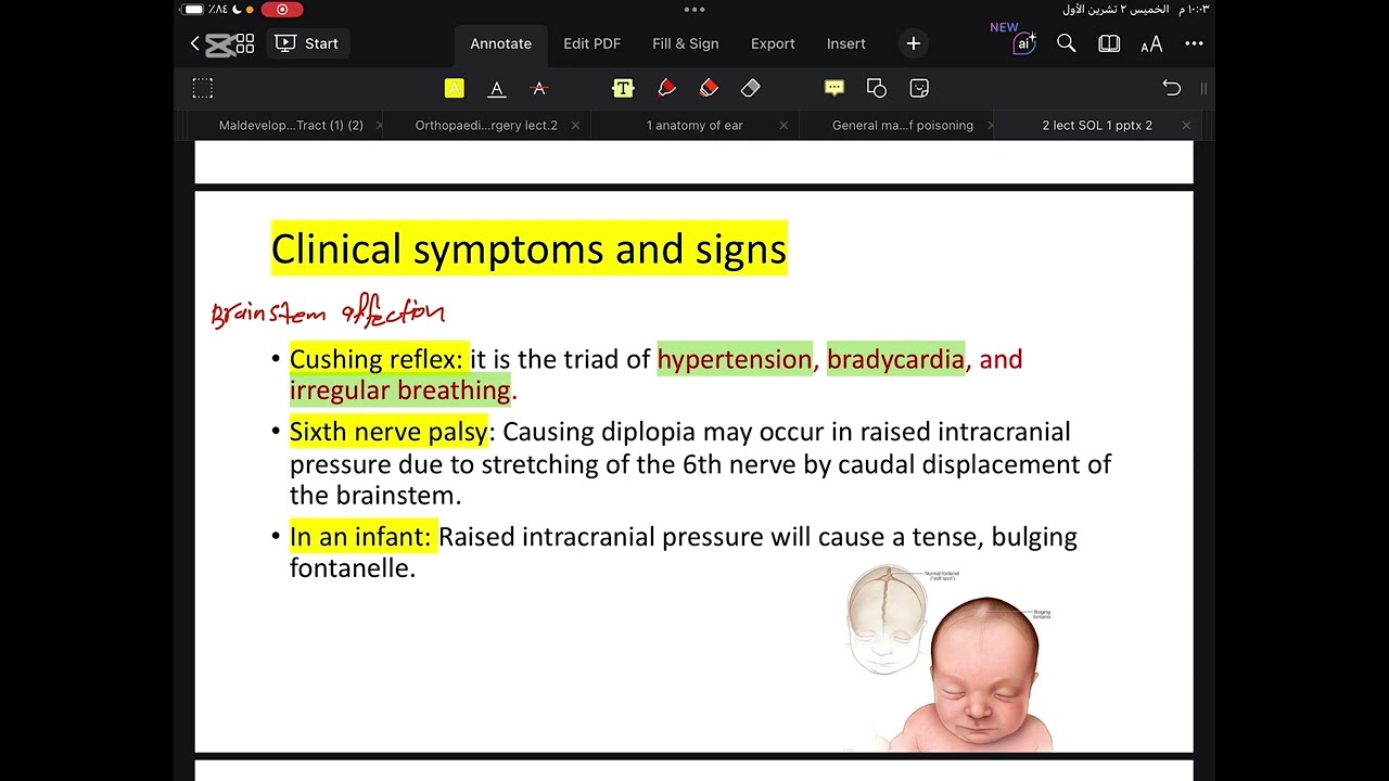 Neurosurgery  ( 5th stage )  || CNS Tumour [ Lecture 2 ]