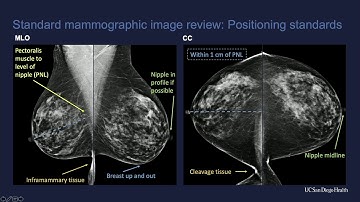 2020 Clinical Breast Imaging and Interventions Update- A Video CME Teaching Activity
