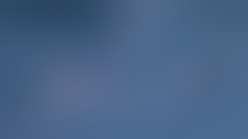 ATOMS insertion (Post Prostatectomy)