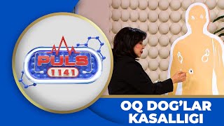 Puls 1141 - OQ DOG\'LAR KASALLIGI