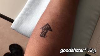 明日は手術。その名は『骨折観血的整復固定術』…#012