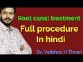 ROOT CANAL TREATMENT IN HINDI | root canal treatment procedure | what is root canal |