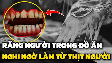 Liên tiếp phát hiện “răng người” trong đồ ăn , dân mạng rùng mình nghi nguyên liệu lạ | Tin hôm nay
