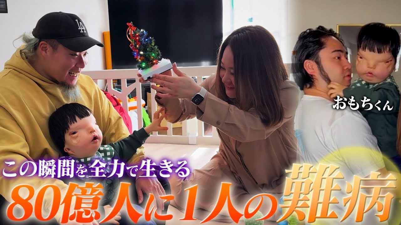 「僕は可哀想な子じゃない」世界でも前例のない病と闘うおもちくんにクリスマスプレゼント