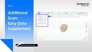 Intraoral Scan Course EP25｜Additional Scan: Easy Data Supplement