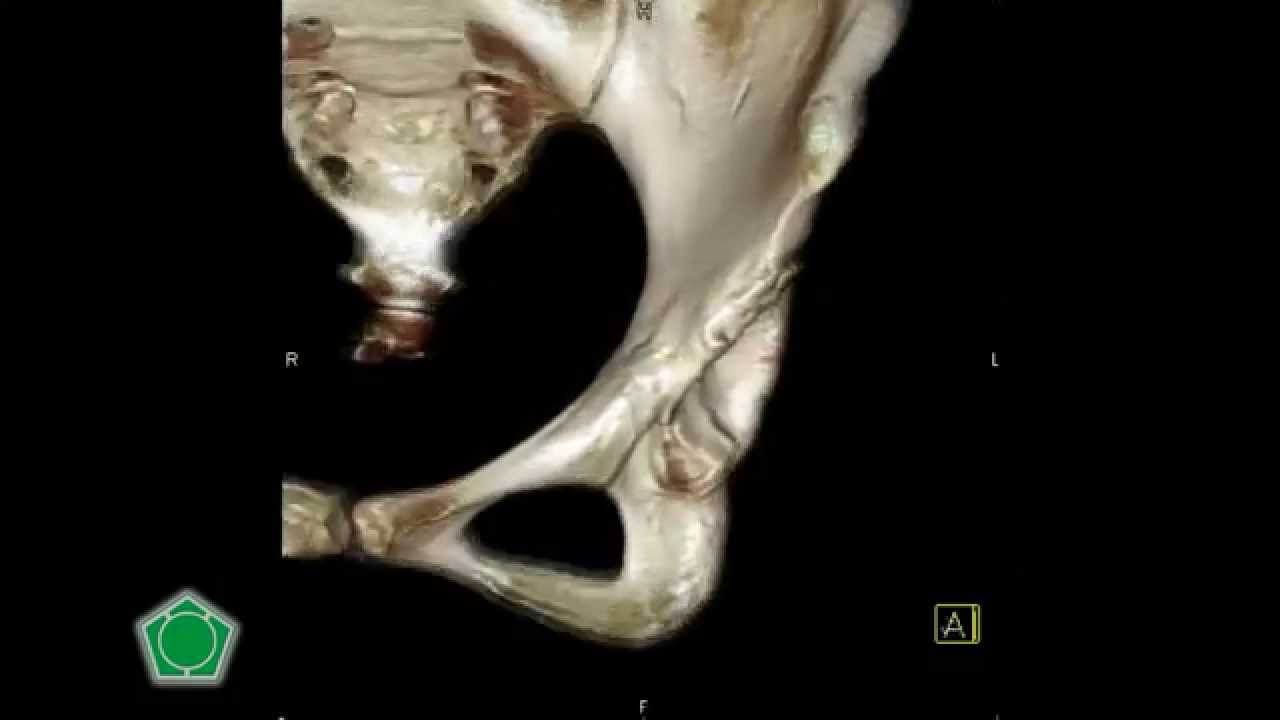 health industry cybersecurity practices Articulación Coxofemoral