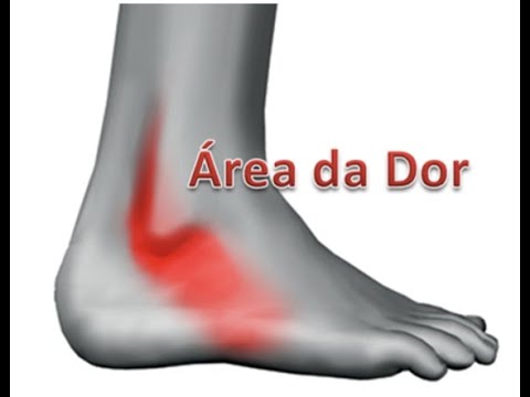 Vídeo: Onde está o tendão fibular?