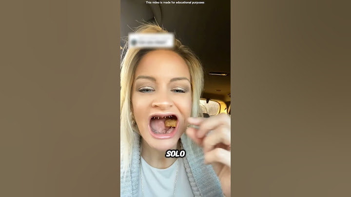 The truth behind her fake smile 😯