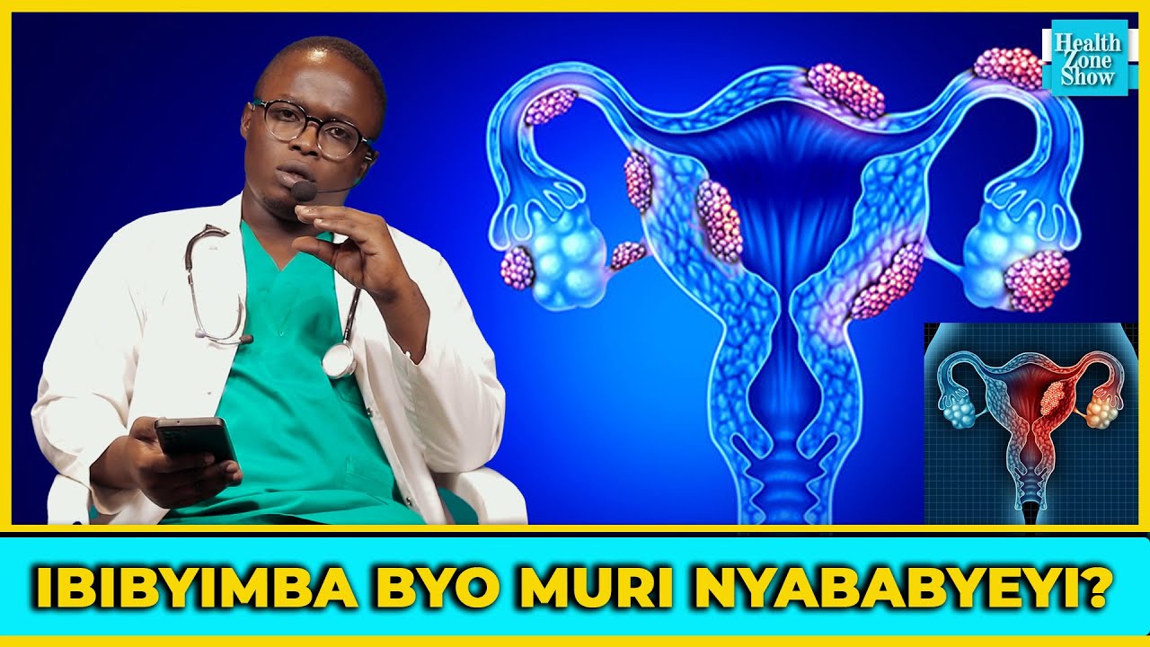 IBIBYIMBA BYO MUNDA KU BAGORE NA ABAKOBWA, KORA IBI BINTU WIRINDE!