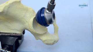 Total Hip Replacement System Cemented