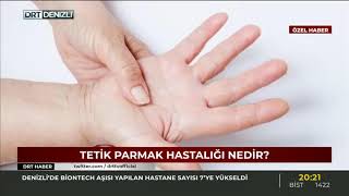 Tetik Parmak Hastalığı - Prof. Dr. M. Nazım Karalezli