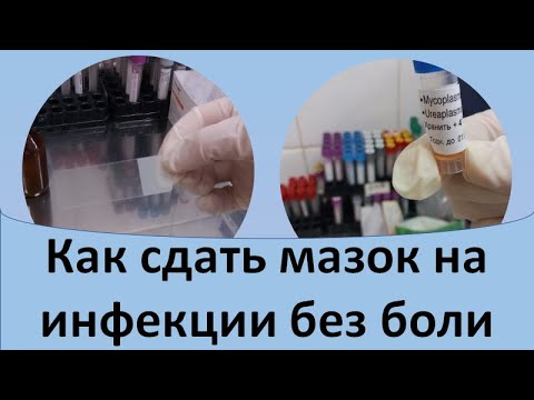 Как сдать мазок на инфекции без боли