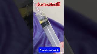 ปวดเข่า หน้าหลัง สาเหตุ? #หมอเก่งกระดูกและข้อ #ปวดเข่า #ข้อเข่าเสื่อม #เข่าอักเสบ #bakercyst