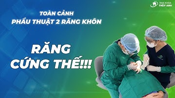 TOÀN CẢNH - CHÂN THẬT Những Điều Diễn Ra Trong case Nhổ 2 Răng Khôn Cùng Lúc