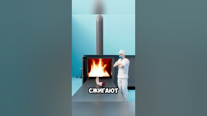 Он хотел продать свою ногу @zackdfilms