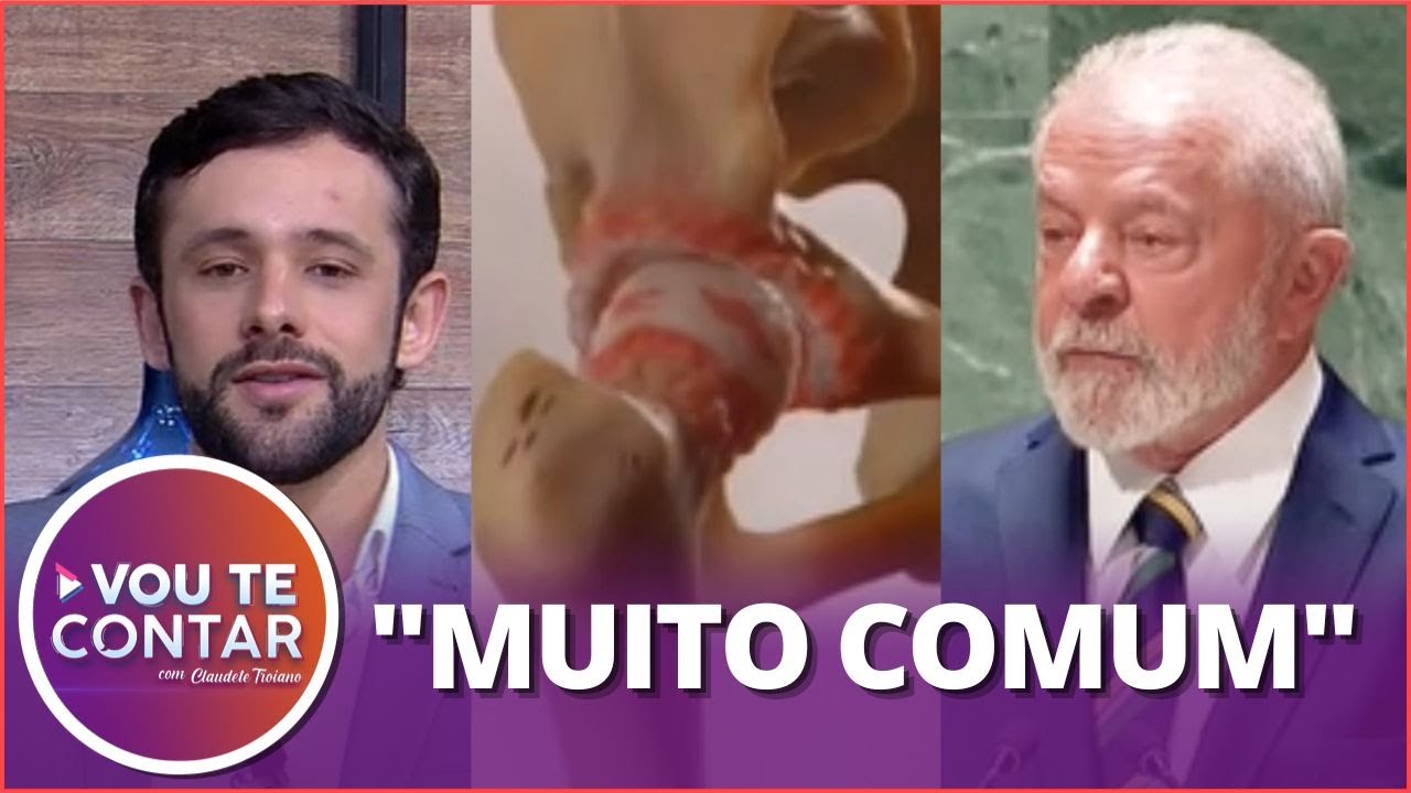 Artrose no quadril: Saiba como é a cirurgia feita pelo presidente Lula