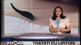 varicoza decât tratai tabletele cauze de varicoza