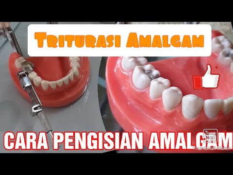 Video: Apa Itu Amalgam?