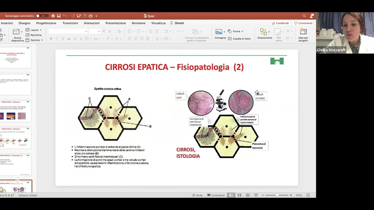 Cirrosi Epatica: la diagnosi, monitoraggio e fattori di rischio