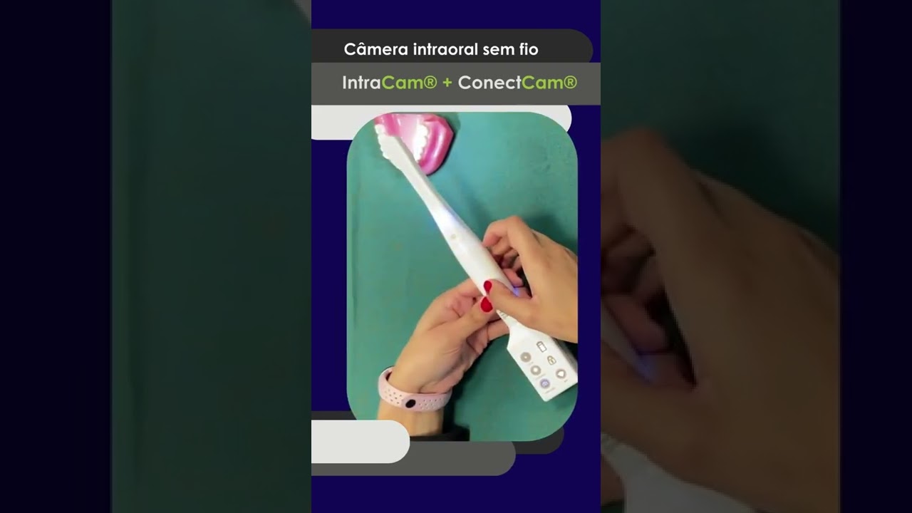 Câmera Intraoral sem fio - Conheça o combo IntraCam + ConectCam da ActiveWare