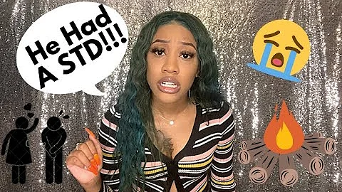 STORYTIME: BURNED AT THE BONFIRE!!! |KAY SHINE