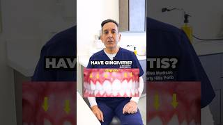 How Do You Know If You Have Gingivitis?!