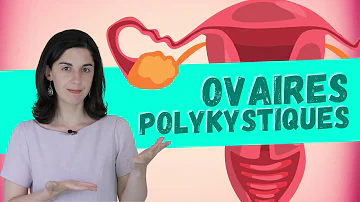 Quel régime alimentaire pour contre les ovaires polykystique