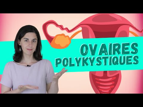 Vidéo: Comment traiter le syndrome des ovaires polykystiques (SOPK) : 11 étapes