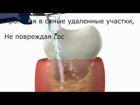 Как работает Vector